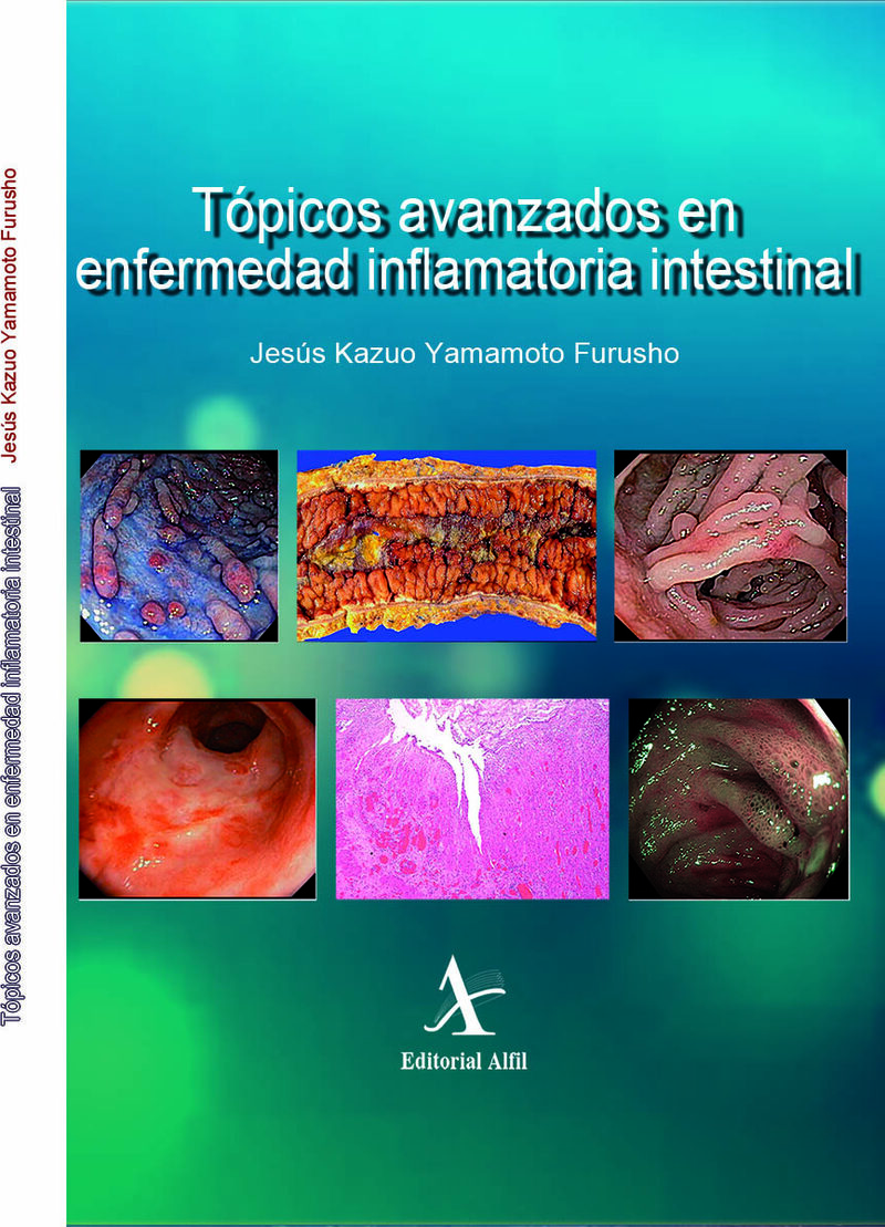 Portada de Tópicos avanzados en enfermedad inflamatoria intestinal